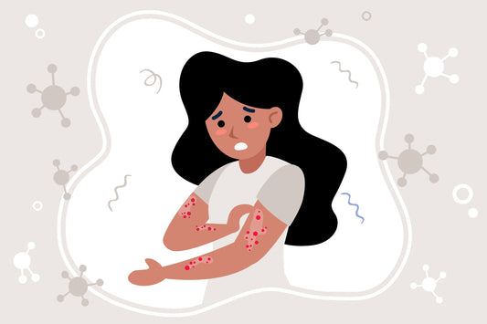 Eczema Relief: How Tencel Bedding Soothes Sensitive, Flaky Skin